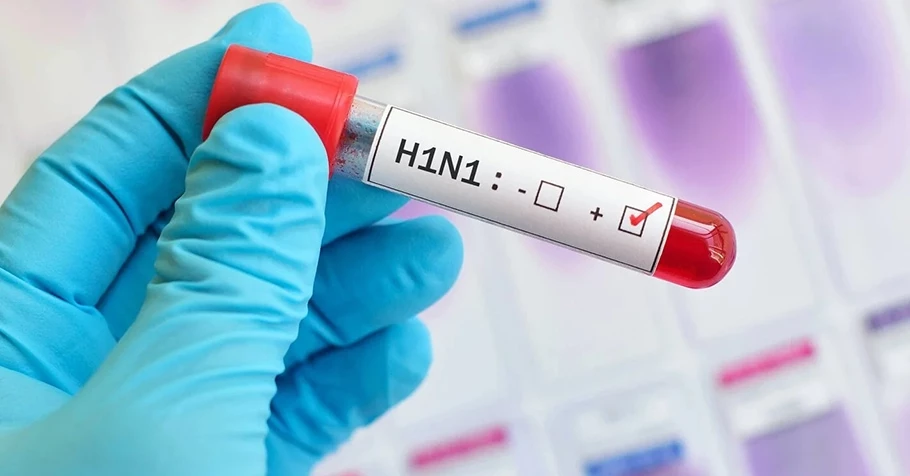 Dấu hiệu nhận biết cúm A và cách điều trị